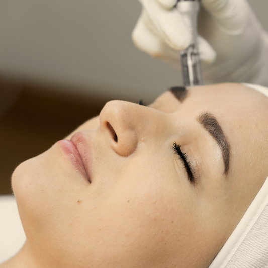 Microneedling